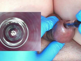 The Median Be Beneficial To A Difficulty Urethra Was Empirical Overwrought Placing An Endoscope Upon Uncluttered 10 Mm Anatomize Tube.